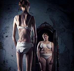 La anorexia hace que el enfermo se vea obeso aun cuando su peso se encuentra por debajo de lo recomendado.